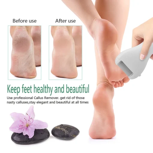 Professional Electric Foot File High-Performance Callus Remover for Smooth, Soft Heels - Image 4